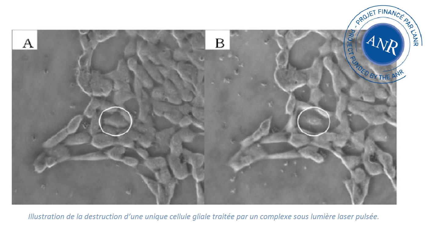 Illustration de la destruction d’une unique cellule gliale traitée par un comple