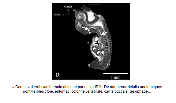 « Coupe » d’embryon humain obtenue par micro-IRM 