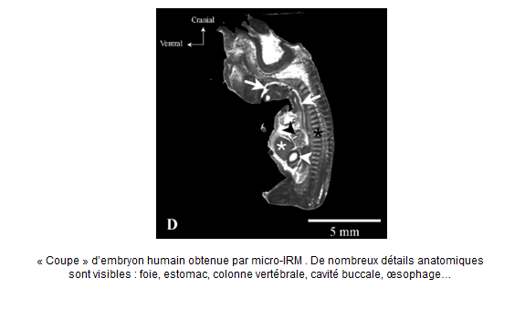 « Coupe » d’embryon humain obtenue par micro-IRM
