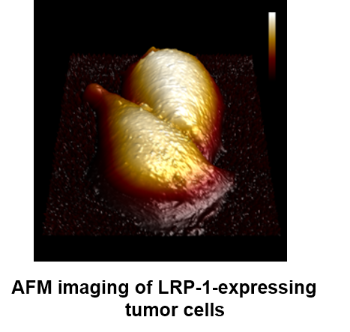 AFM imaging of tumor cells