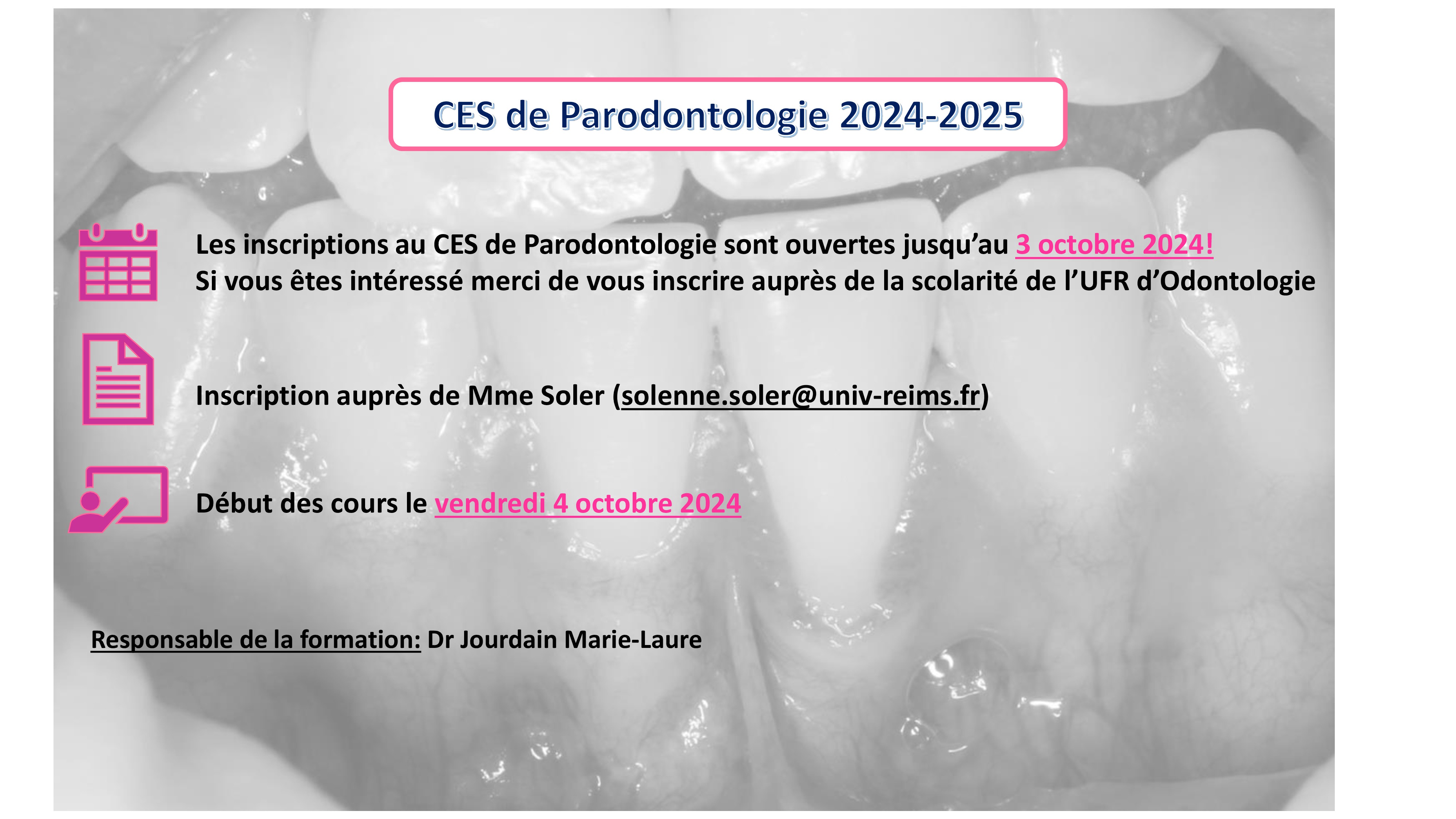 annonce CES