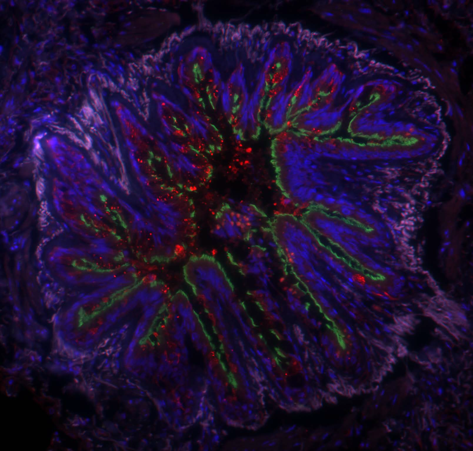 Microscopie à fluorescence (3 lasers)