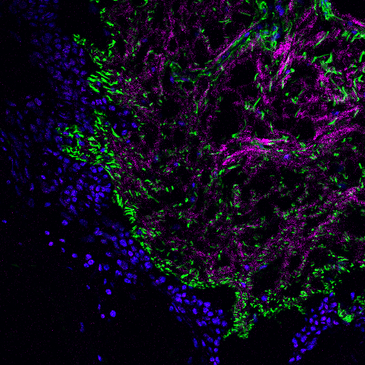 Microscopie à fluorescence (3 lasers)