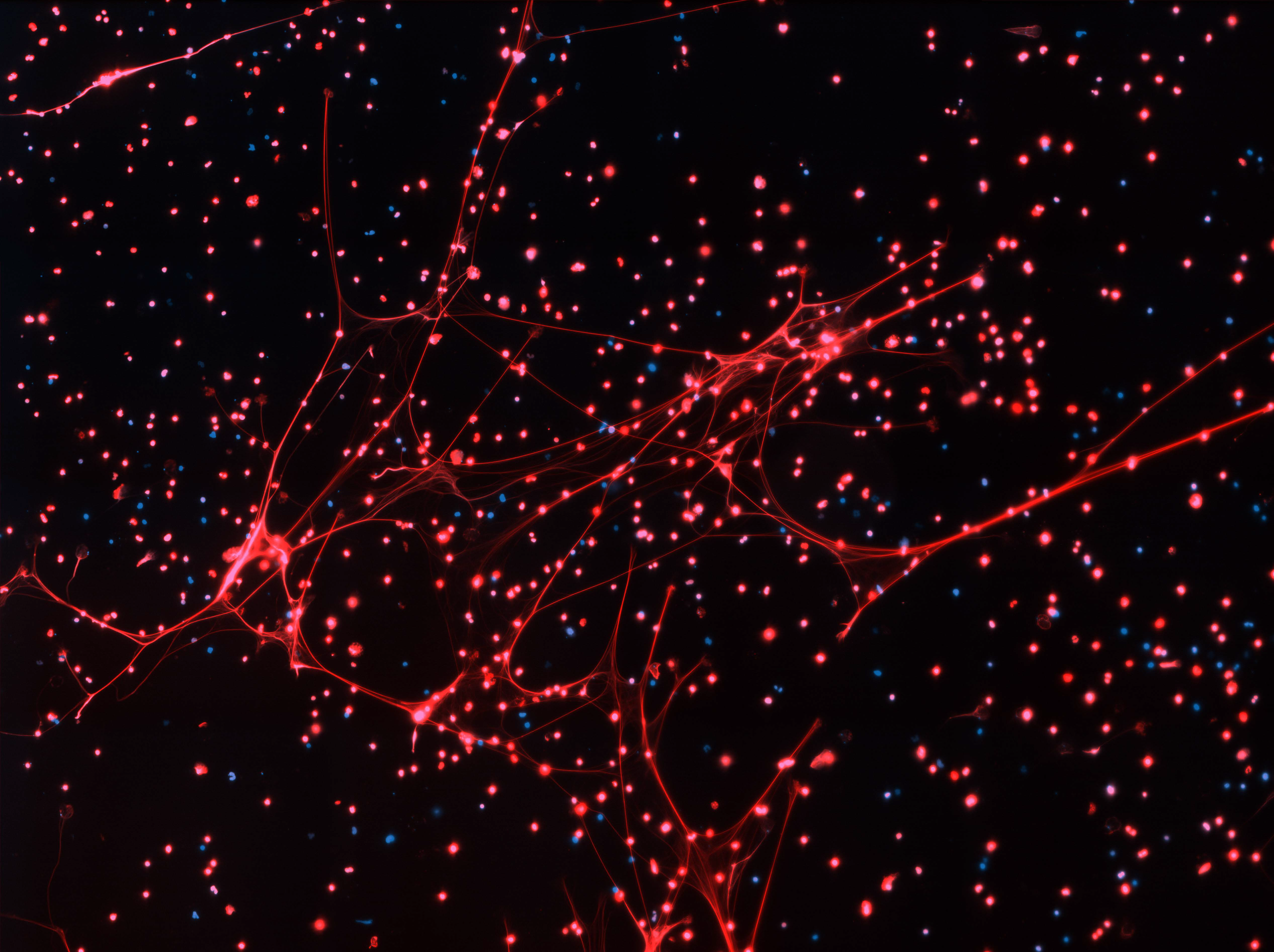 Microscopie à fluorescence (2 lasers)