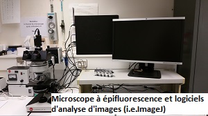 Microscope à épifluorescence