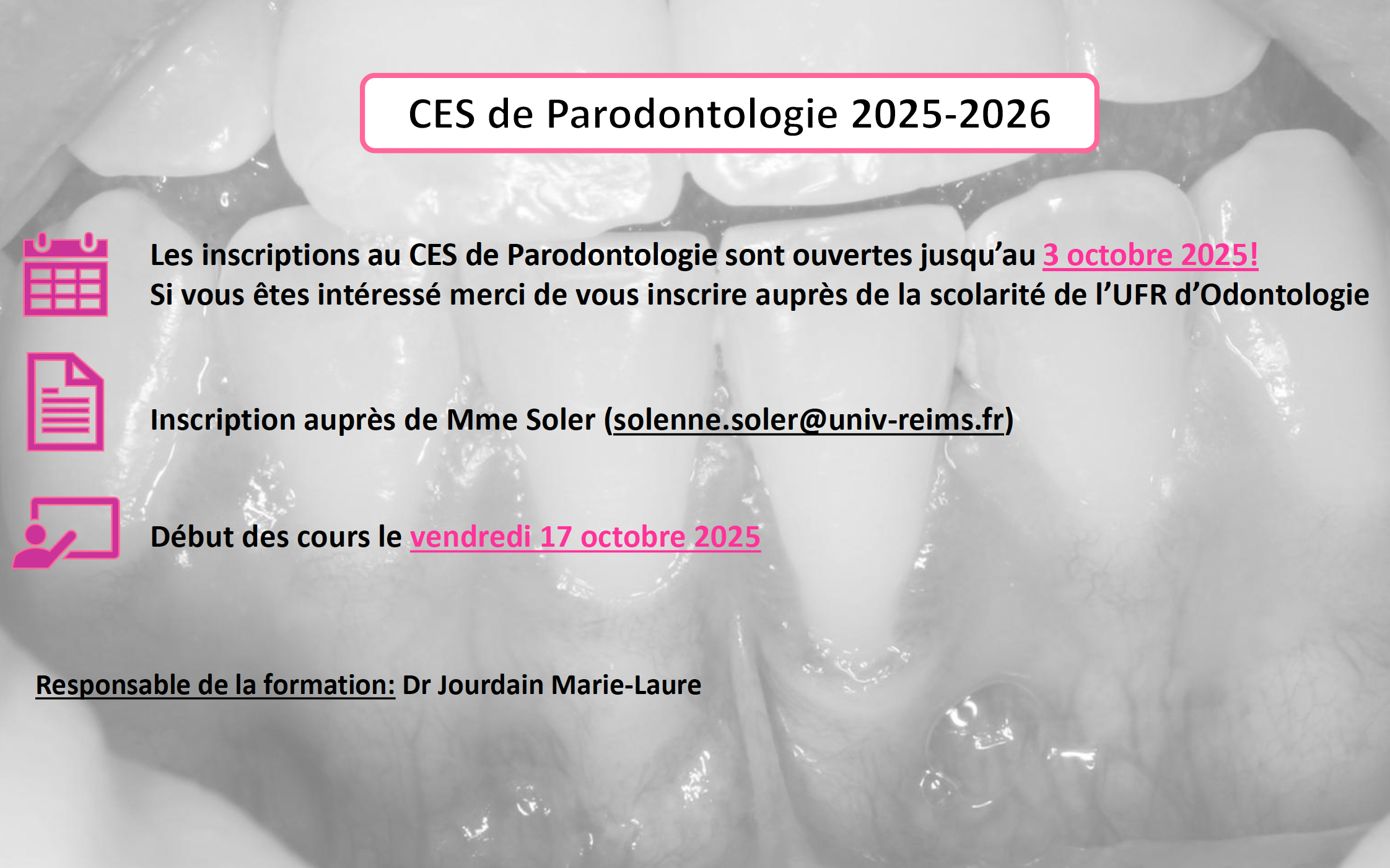 annonce CES